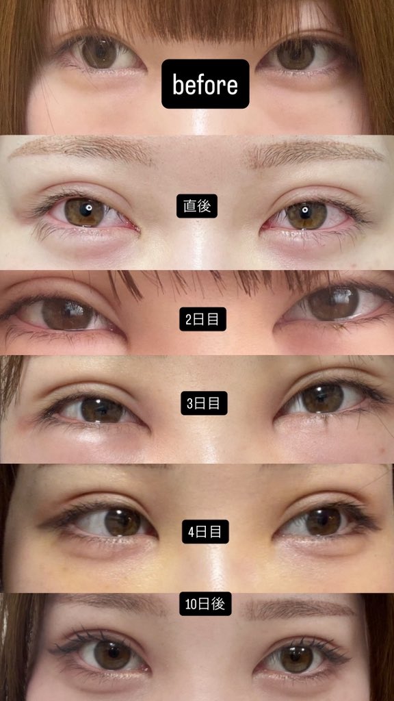 りさ🎀美容垢 tweet media