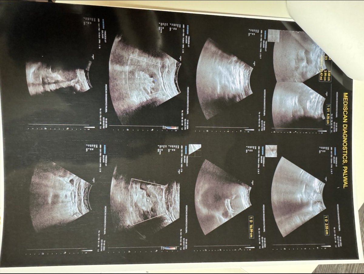 Sourabhr1dx's tweet image. @AxisBank has frozen my account (₹1L+ Gold Loan) over a ₹6091 dispute for 6 months. My grandfather has SURGERY in 2 days! If anything happens, bank is responsible.
RBI Complaint: N202627016002699
@RBI @RBILS_Official @DasShaktikanta #AxisBank #Emergency #Medical