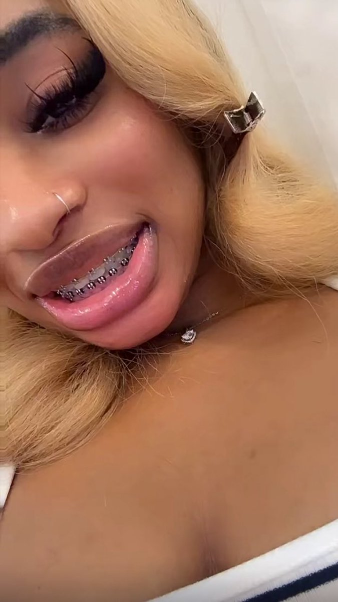 HuntXr🫩 tweet media