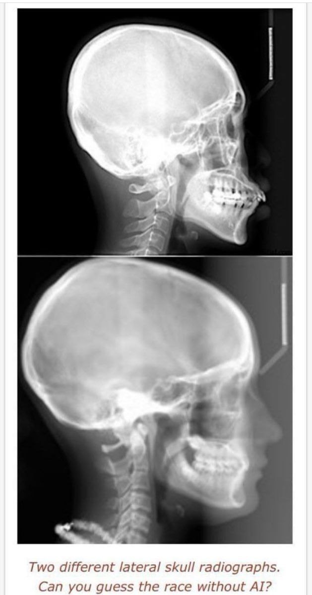 Patricius Albus tweet media