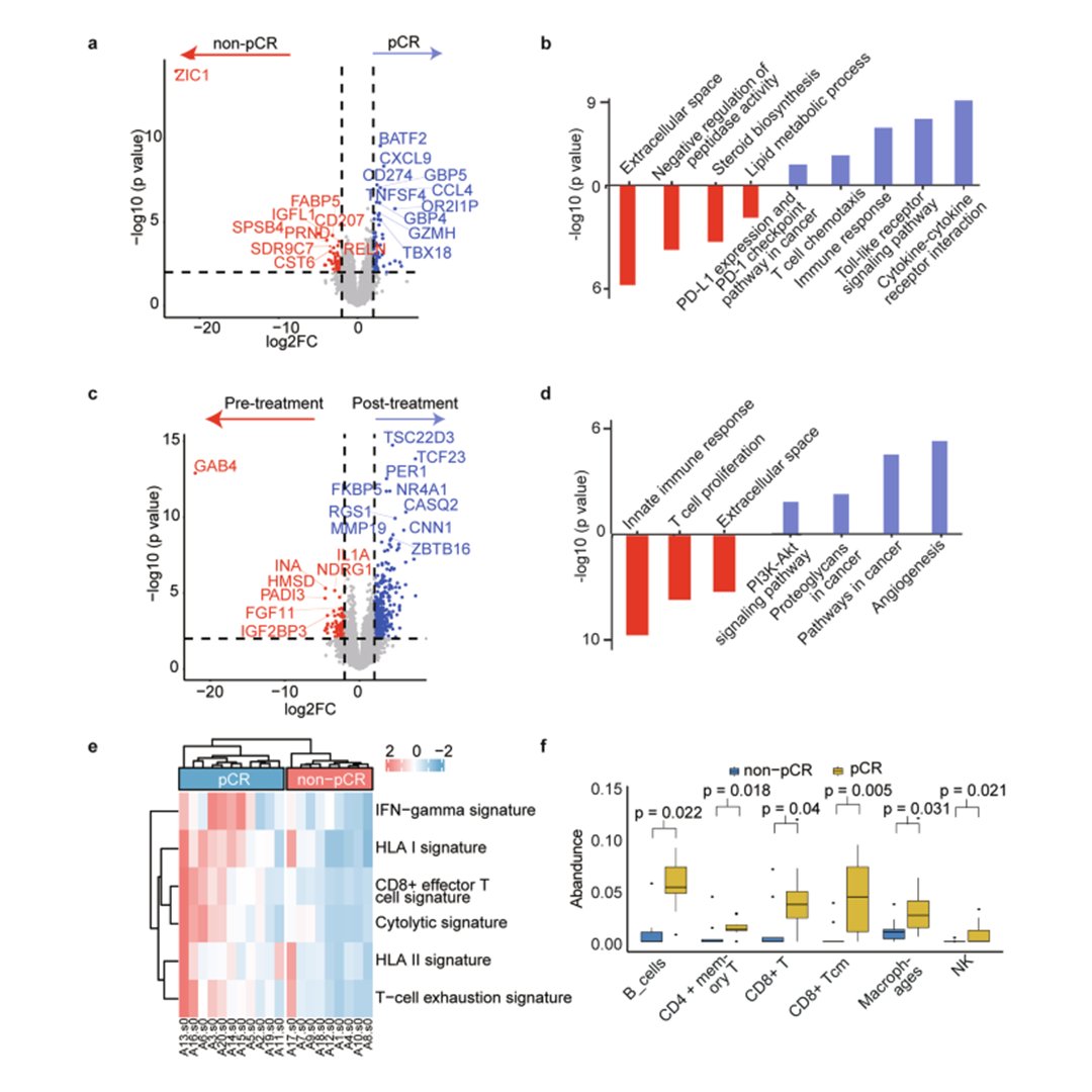 sigtrans_sttt's tweet image. The phase II NATIC trial shows neoadjuvant #Tislelizumab + #Chemotherapy achieves high pathological complete and objective response rates in stage IB3/IIA2 #CervicalCancer with acceptable safety, enhancing surgical efficacy.
#STTT #OpenAccess: doi.org/10.1038/s41392…