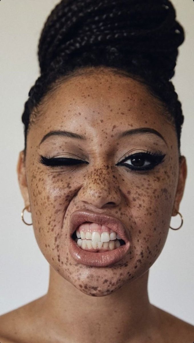 JustCasper_2's tweet image. Girls with freckles has this kind of beauty in them😮‍💨