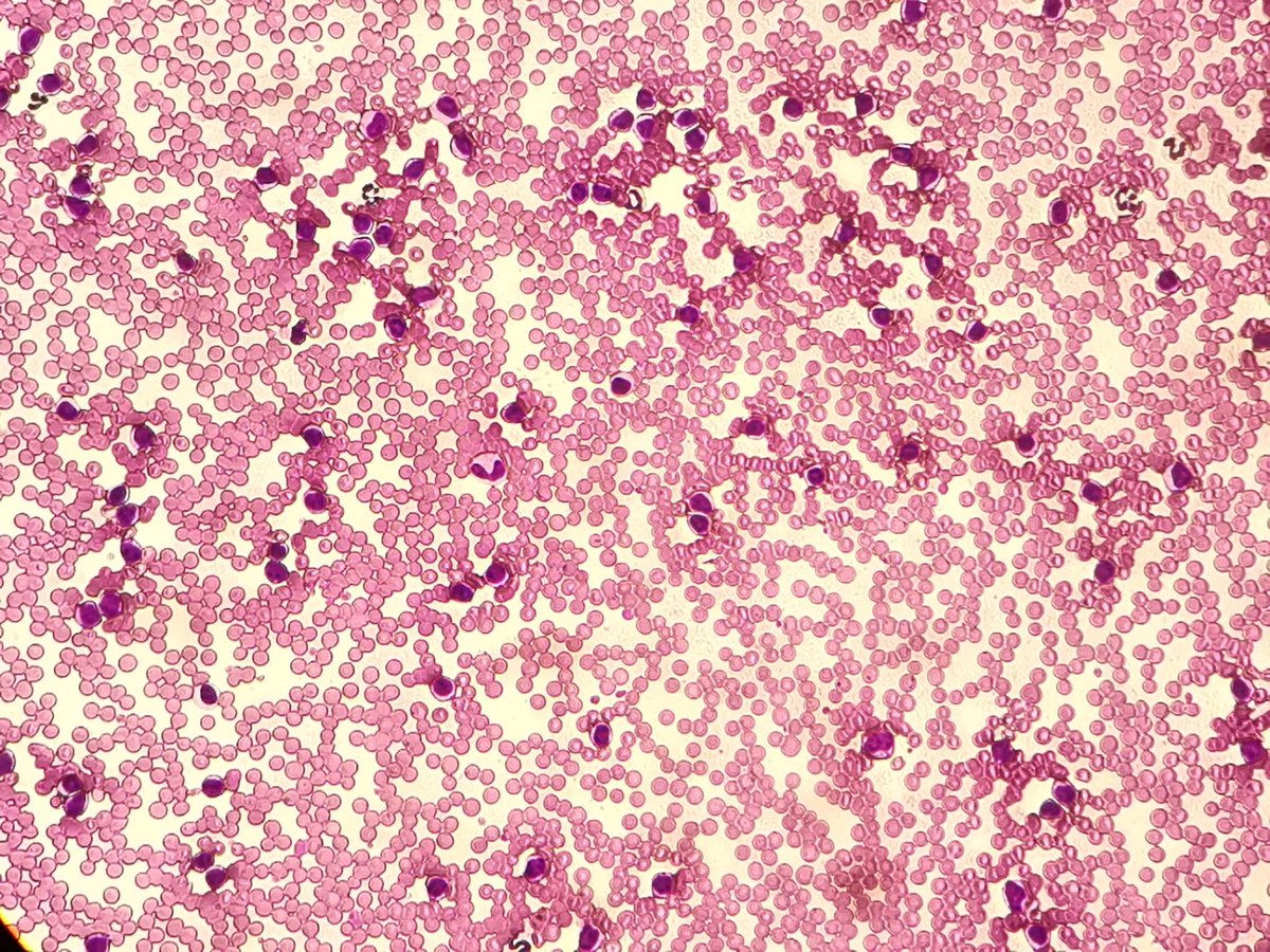 Kai Tapio Ahonen tweet media