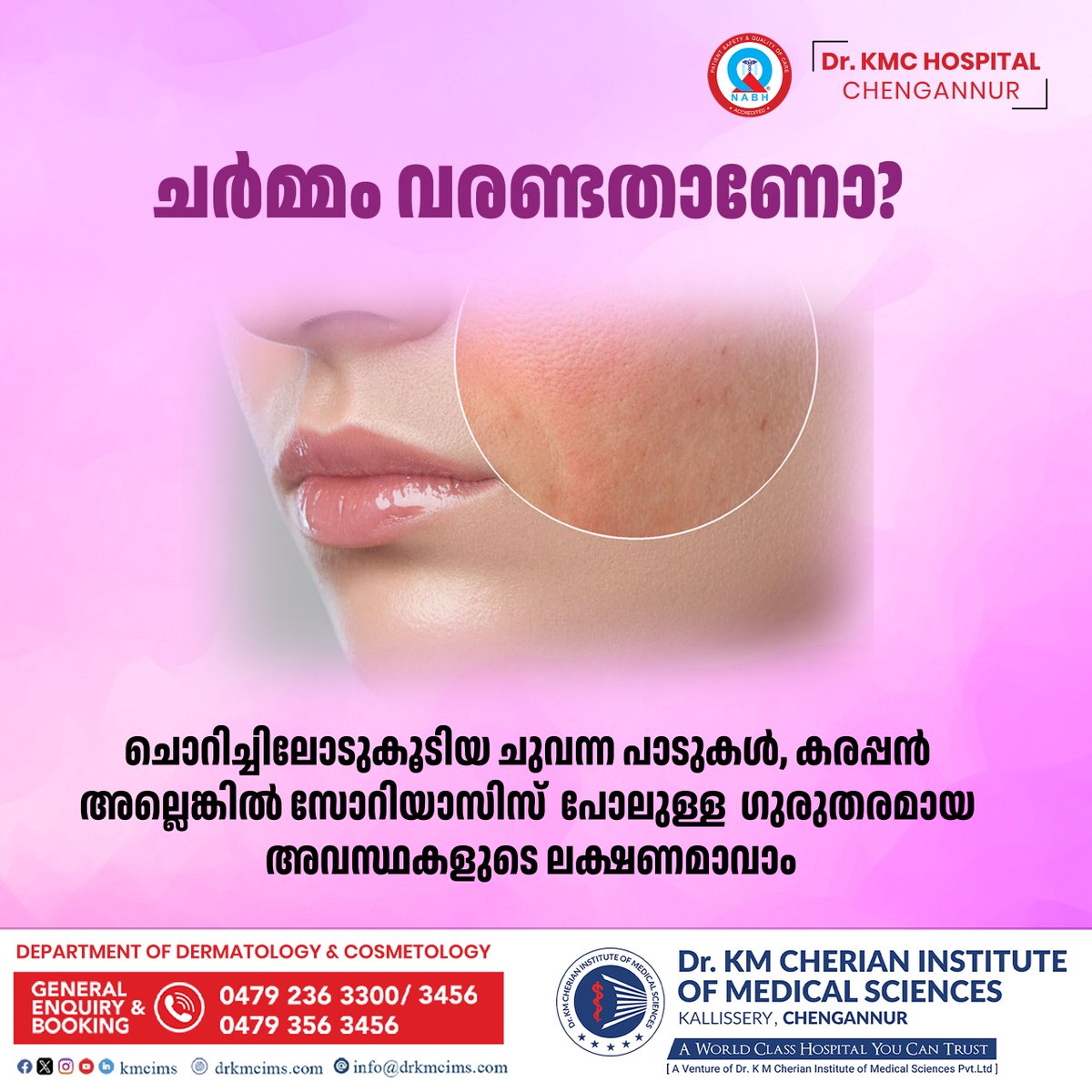 kmcims's tweet image. ചർമ്മം വരണ്ടതാണോ? ചൊറിച്ചിലോടുകൂടിയ ചുവന്ന പാടുകൾ, കരപ്പൻ അല്ലെങ്കിൽ സോറിയാസിസ് പോലുള്ള ഗുരുതരമായ അവസ്ഥകളുടെ ലക്ഷണമാവാം!

For Booking &amp;amp; Appointments: 0479 236 3300

#skindisease #skindiseaseawareness #dermatology #Cosmetology #KMCIMS #KMCHospitalChengannur