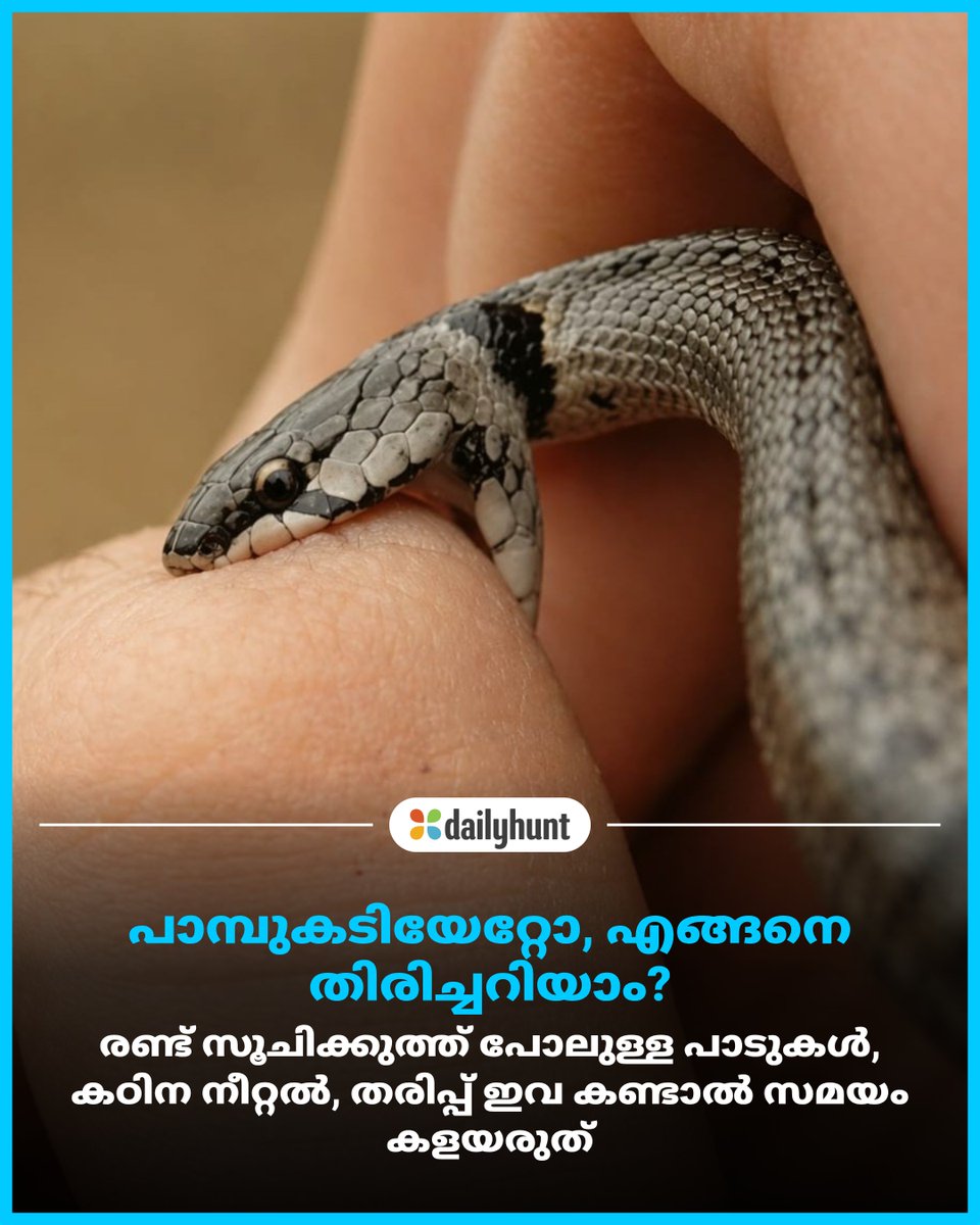 DH_Malayalam's tweet image. വേദനയെ ചെറുതായി കാണരുത് ഇത് വിഷത്തിന്റെ ആദ്യ മുന്നറിയിപ്പ് ആയേക്കാം. ഉടൻ ആശുപത്രിയിൽ എത്തി ചികിത്സ ഉറപ്പുവരുത്തണം
w.dhunt.in/14aygg?partner…
സമഗ്രമായ കാഴ്ചപ്പാടുകൾക്കും, വിശകലനങ്ങൾക്കും #dailyhunt
#SnakeBite #EmergencyCare #SafetyFirst #PoisonousSnake #Lifestyle #Con