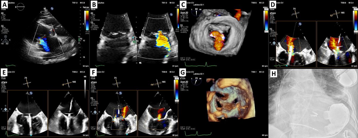 Reviews in Cardiovascular Medicine tweet media