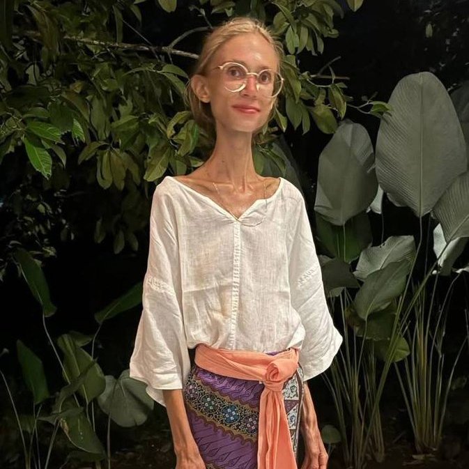 El posmolerdismo no sólo mata el pensamiento racional. La 'influencer' polaca Karolina Krzyzak ha muerto en Bali a la edad de 27 años. La causa: alimentarse con una dieta exclusiva de frutas. Pesaba 22 kg en el momento de su fallecimiento.