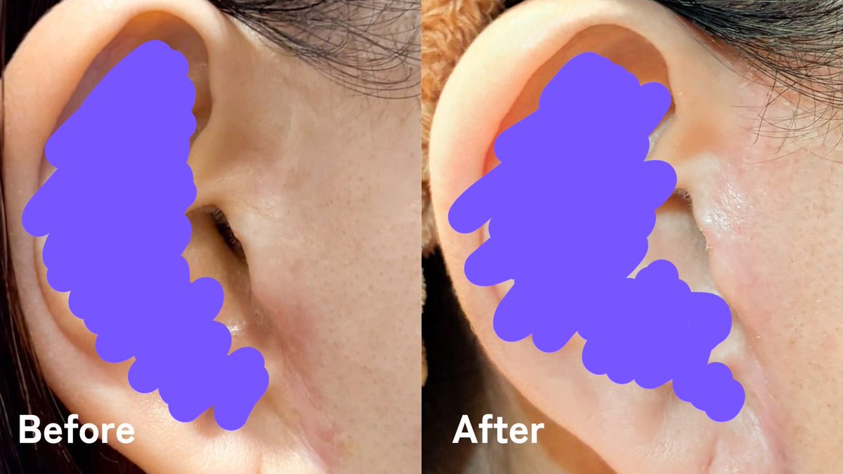 🐱すばらしい🍤巨顔🐱 tweet media