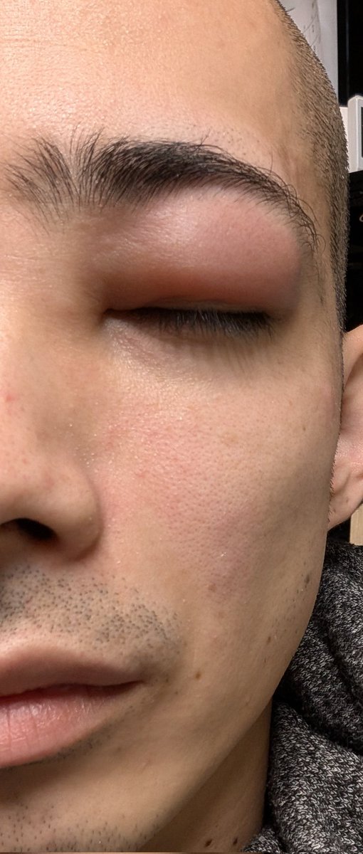 限界坊主かみやま tweet media