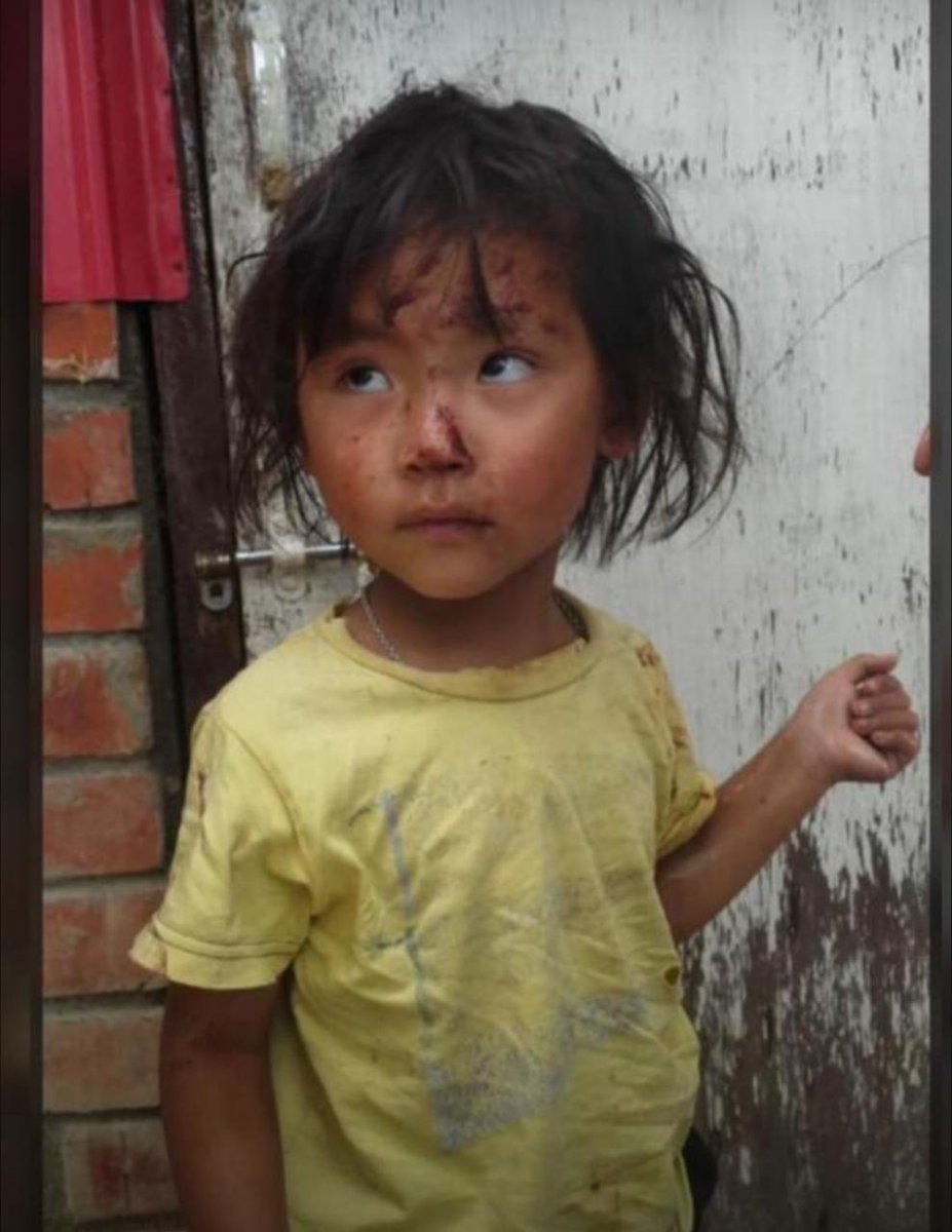 KhongsaiChanu's tweet photo. Mullam Kuki village📍
An innocent child was injured and her mother, along with several others were shot in the attack by NSCN-IM militants. No child should face such trauma. This tragedy highlights the urgent need to protect civilians, especially the most vulnerable & hold those responsible accountable.

@HMOIndia @PMOIndia @INCIndia @PIBHomeAffairs @MIB_India @MOMAIndia @thewire_in @CBC_MIB @India_NHRC @UNHumanRights @UNGeneva @unwomenchief @WSJ @PTI_News @vijaita @themojostory @vijaita @SCJudgments @LiveLawIndia @MLJ_GoI @TheLallantop @TribalArmy @TribalAffairsIn @DeccanHerald