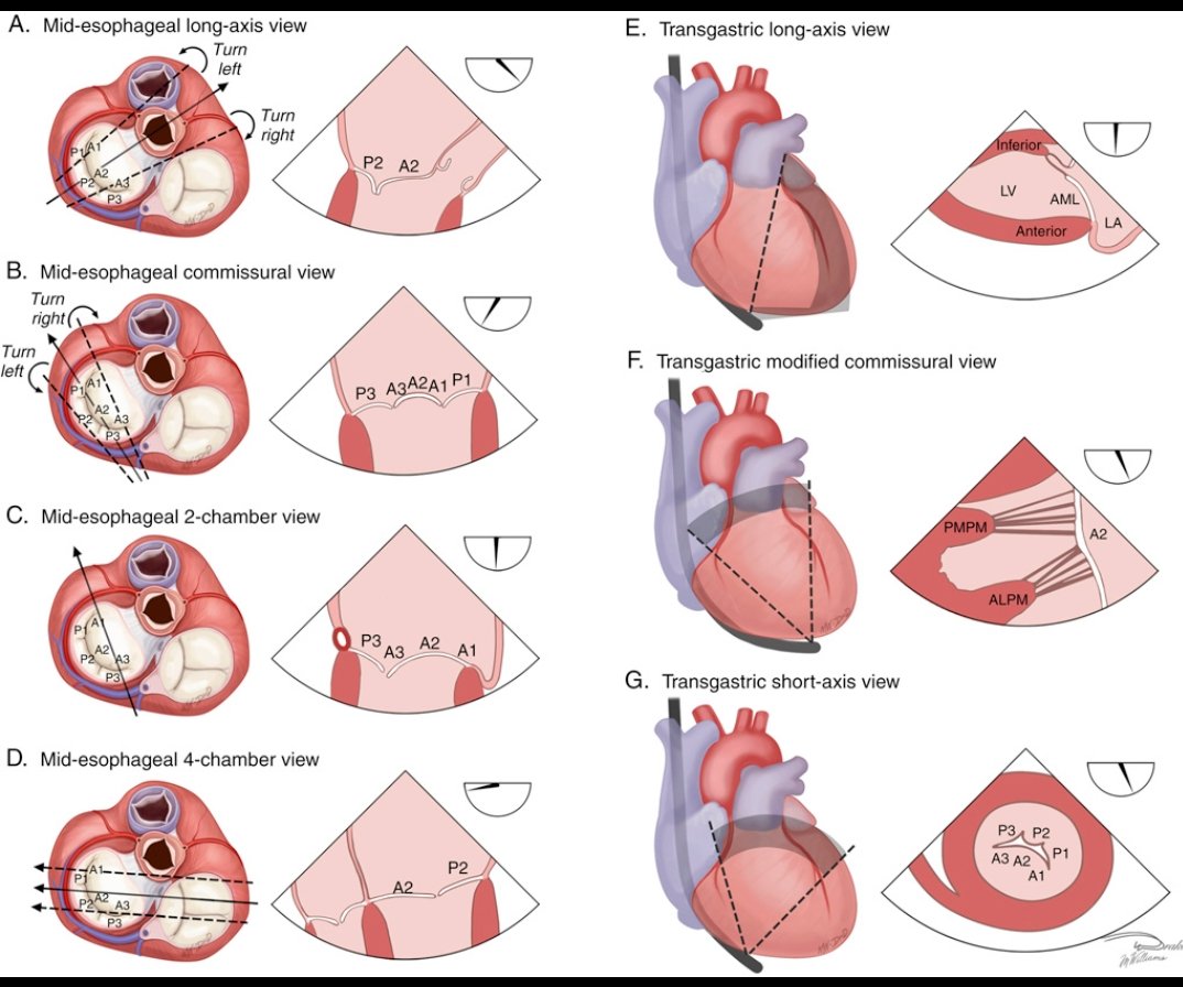 CardiovascularCorner tweet media