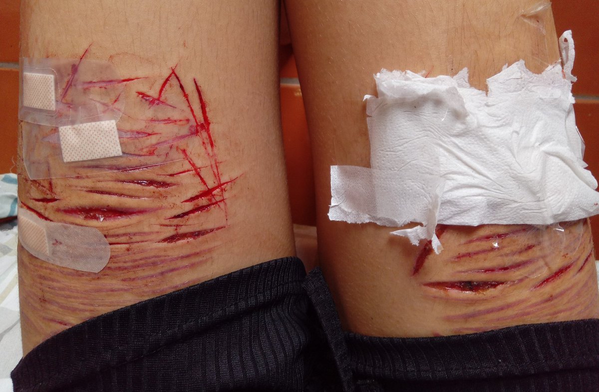 𝗄𝖺𝗂 ♱ tweet media