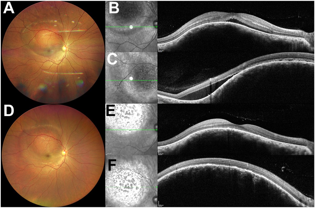 American Academy of Ophthalmology tweet media