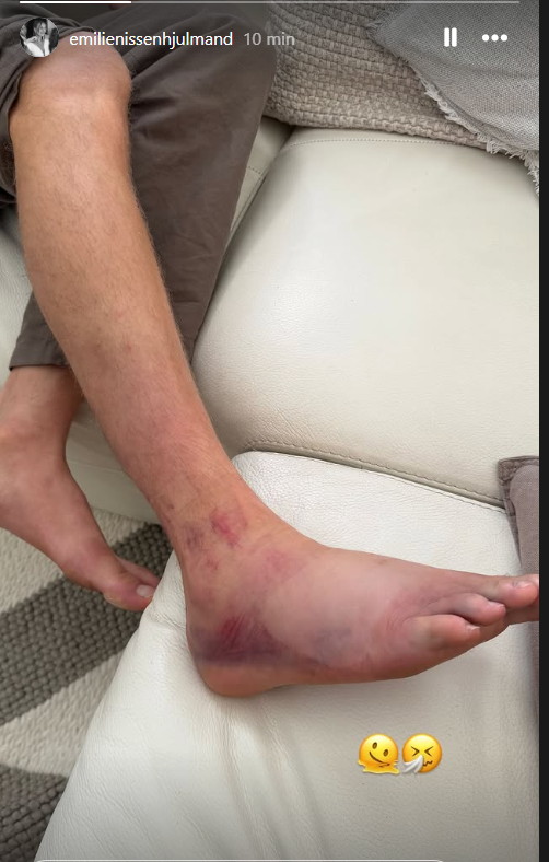 O pé de Hjulmand, revela a mulher.