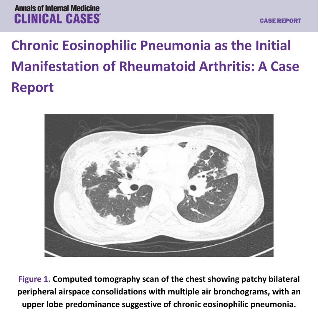 Annals of Internal Medicine: Clinical Cases tweet media
