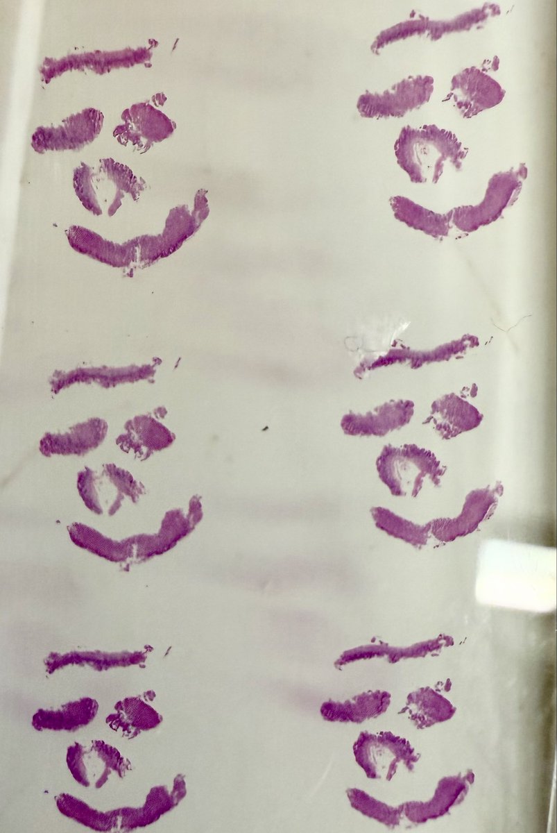 MeredithKHerman's tweet image. Our histotechs @UMichPath are the best!
A reminder to smile and find joy in our work 😊
#PathX #GIPath #PathArt #Labweek