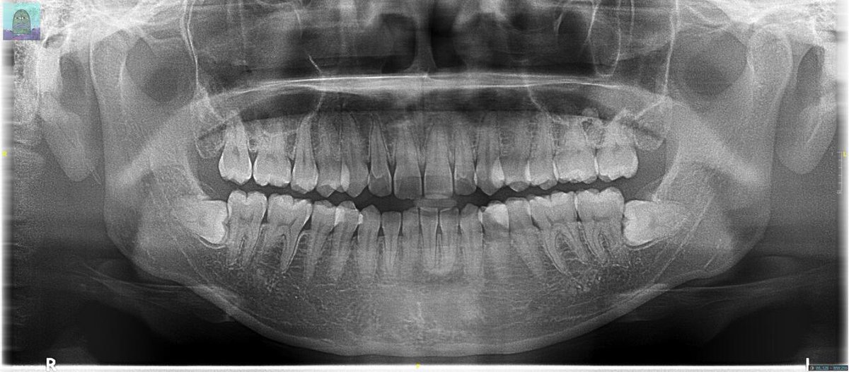 Tanyarl 💚 tweet media