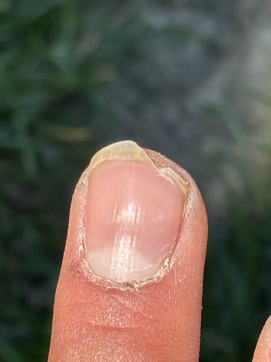 j’avais prévu dme faire une semi permanente pr les beaux jours et j’viens de me faire ça ??? j’ai envie de caner