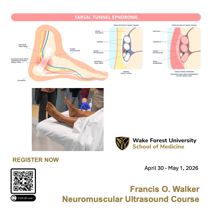 UltrasoundWake's tweet image. Sign up for our #Neuromuscular #Ultrasound #Course!
northwestahec.wakehealth.edu/t3/courses-and…

---
@AtriumHealthWFB @UltrasoundWake @wakeforestmed #onlineclass  #scanning #cometrainwiththebest #healthcareexcellence #healthcare #April #virtualdidactics