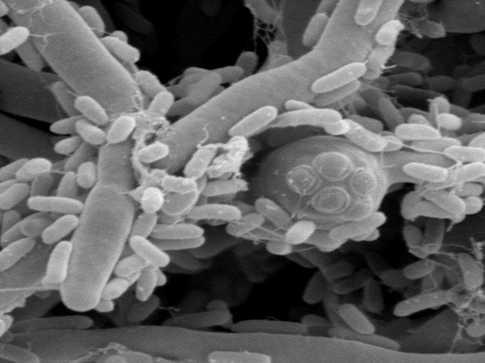 MRCcmm's tweet image. 🧫 A smiley face… made by bacteria 😊
Pseudomonas aeruginosa can kill one form of the fungus Candida albicans, but not another. Sometimes they even grow together in biofilms, showing how microbes can compete and cooperate🔬 

#Microscopy #Science #Fungi #Mycology #ImageOfTheWeek