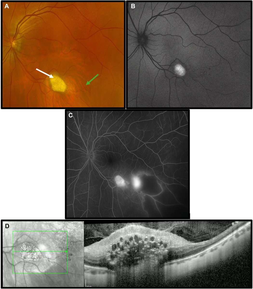 Ophthalmology tweet media