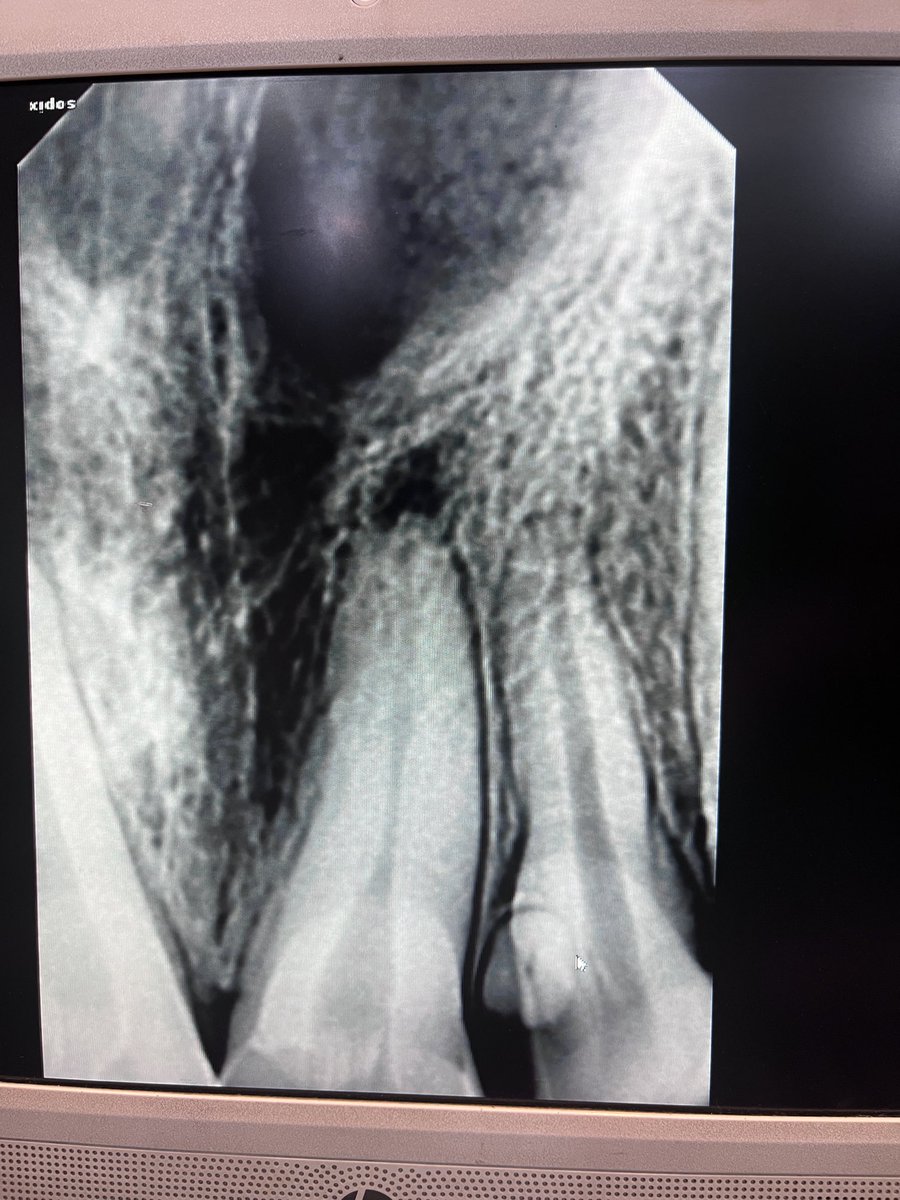 dassnikhil's tweet image. Whats the #Dental Miracle here ..???