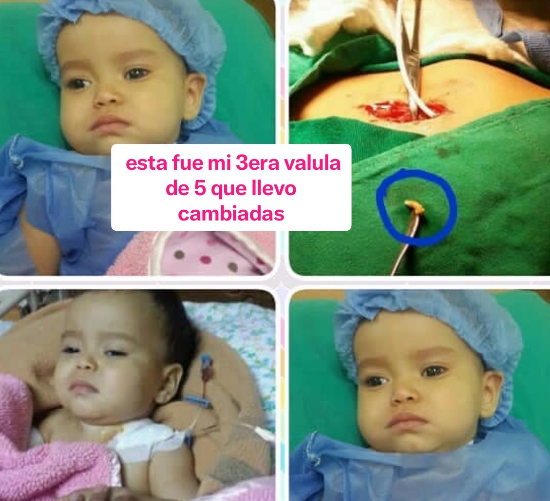 El bombín d mi valvulita s siente un poco duro y el catéter deben verlo,ya q he crecido son $80 la consulta más el traslado agradezco la colaboración
Mercantil
04246549764
17659326

Banesco
04245649764
14171258

Zelle
katyka2628@gmail.com
Xiomara g

  gofund.me/44d83ff1