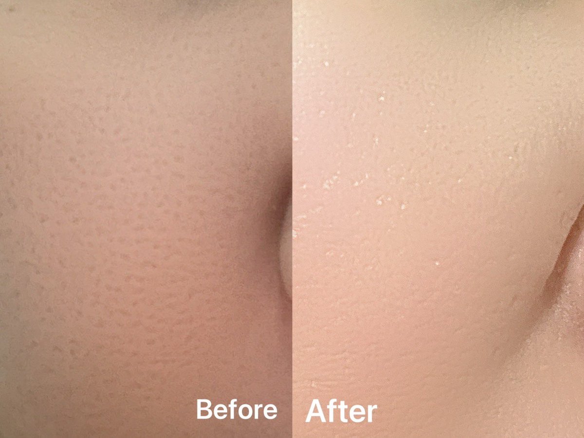am_pui's tweet photo. Merrez'ca all day matte Cushion คุชชั่นเนื้อแมตต์สายลุย กันน้ำ กันเหงื่อ กันแดด ปกปิดไม่อุดตัน คุมมัน เนื้อบางเบา ไม่เป็นคราบ

#merrezca https://t.co/cyOJcJJN2V