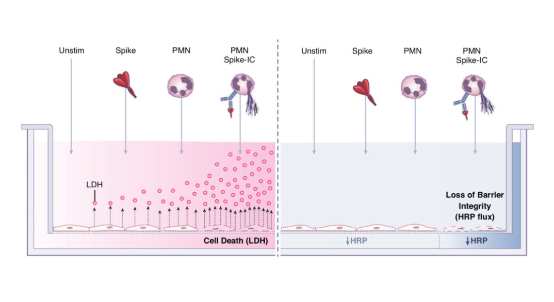 polybioRF's tweet image. Breaking: New PolyBio-supported Study Identifies Microclots, Endothelial Injury Markers and Neutrophil Activation in Children and Young Adults with Long COVID

A new study supported by PolyBio Research Foundation studied children and young adults with Long COVID, providing