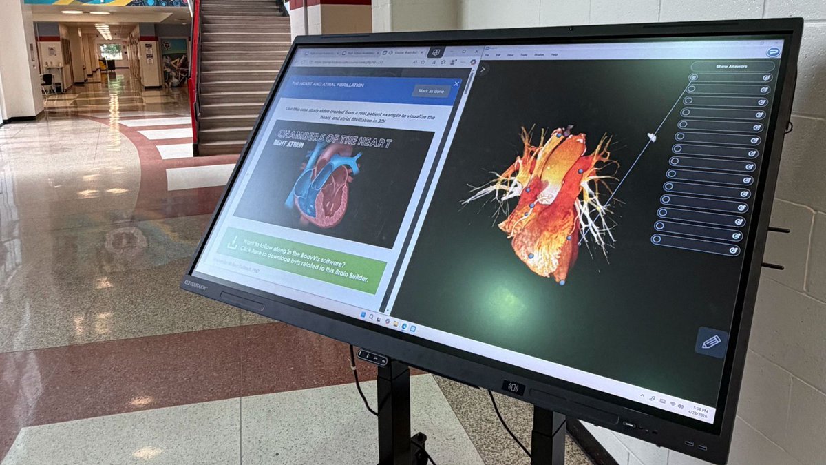 BODYVIZ's tweet image. We had a great time at Hartman Middle School’s Health Night yesterday! 🧠✨

Our BodyViz Anatomy Table was on display, giving parents and students a hands-on look at how interactive 3D learning enhances student understanding and engagement.

#BodyViz #EdTech #HealthEducation