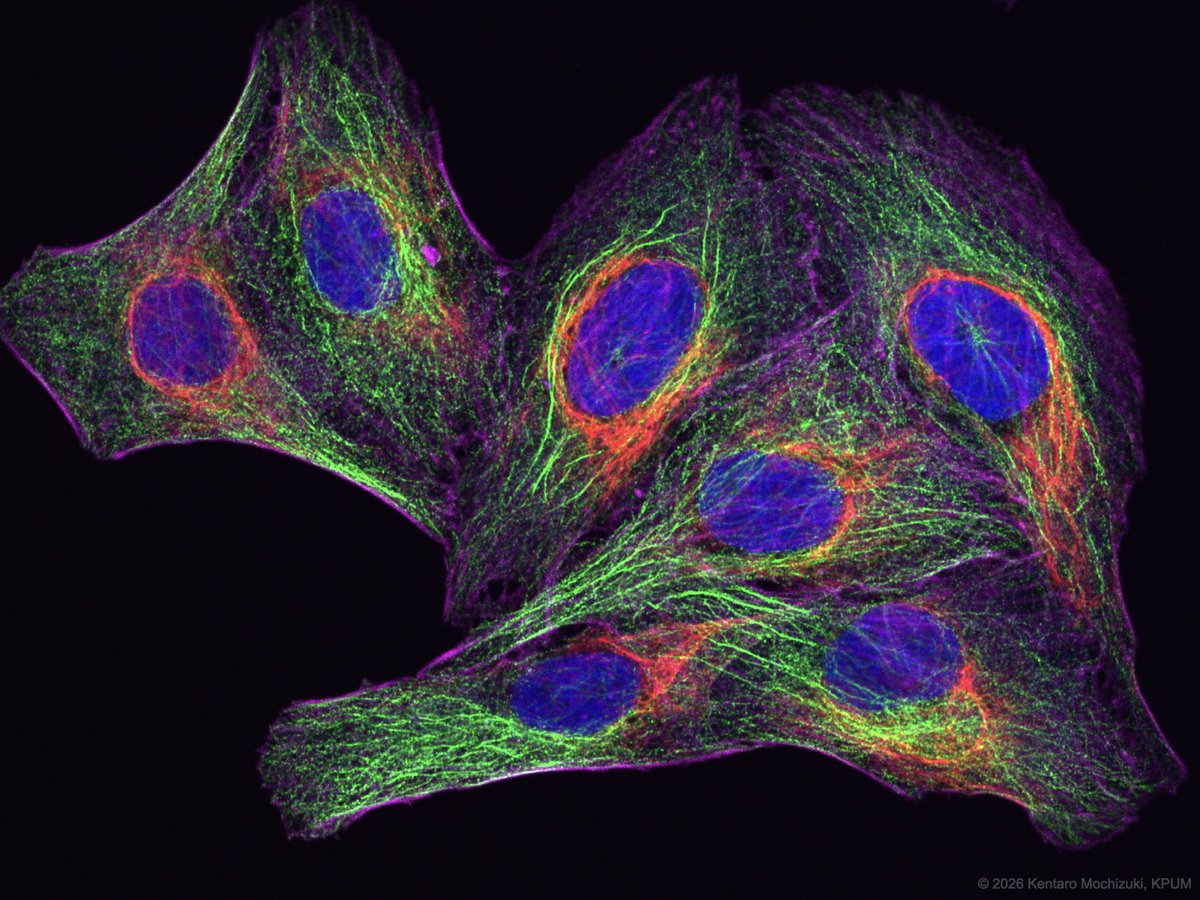 kentmochizuki's tweet image. Confocal is finally office-sized;)
Thanks KEYENCE for bringing us a demo of the new confocal unit. Easy to use, enough image quality. Attached is one of best shots: αTubulin(G)/Vimentin(R)/Actin(M)/Nucleus(B) of HeLa. 

BZ-X1000, BZ-XLC1 @KeyenceMicro 
#Confocal #Microscopy #HeLa