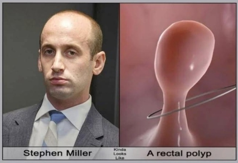 MediaBusters6's tweet image. "The Ballad of Stephen Miller"
His head looks like a penis because he’s such a dick!
Even a rectal polyp would make a better WH advisor
Bruce Kluger’s shit-kickin’, guitar-pickin’ new album, “MAGA Country”
youtu.be/v49Pxsshz1o?si…
#CrimesAgainstHumanity
#CrimesAgainstChildren