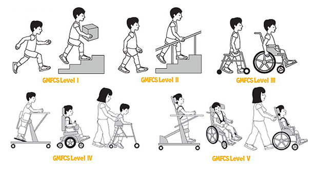 Seatingdynamic's tweet photo. The GMFCS tool helps families and clinicians understand a child's motor skills and guide equipment choices. Learn more: https://t.co/1VjzoNiNMt #GMFCS #GrossMotorSkills #PediatricTherapy #ChildDevelopment https://t.co/YlTowmFlnA