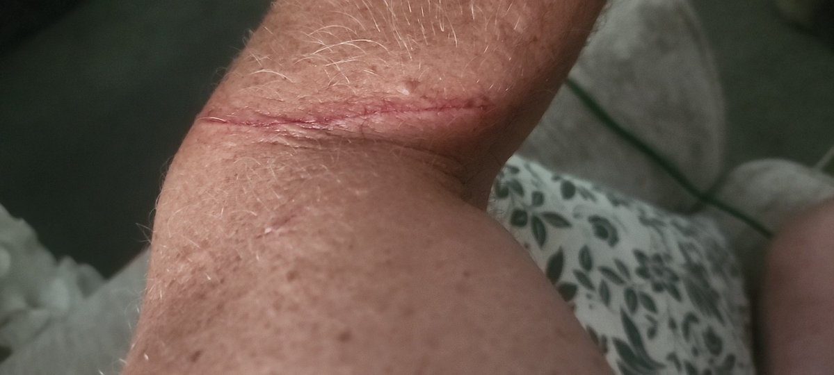 matthewd4's tweet image. I've been damaged. Attacked. Viciously! Aliens will heal me though. #maga