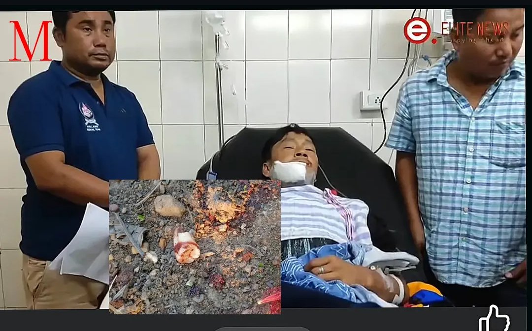 AboriginalKuki's tweet photo. Hey @ukhrultimes, while you’re busy printing the NVG’s "denials," your boys left something behind in Mullam Kuki Village. It seems one of the militants you airlifted for VIP treatment in Imphal forgot his tooth in the village he was busy raiding. 

​Feel free to come and collect it we kept it safe as a souvenir of your "peaceful morning patrol." Maybe next time, stay home and keep your teeth (and your dignity) intact. #Manipur #MullamVillage #LostAndFound #TangkhulMilitants #MediaBias