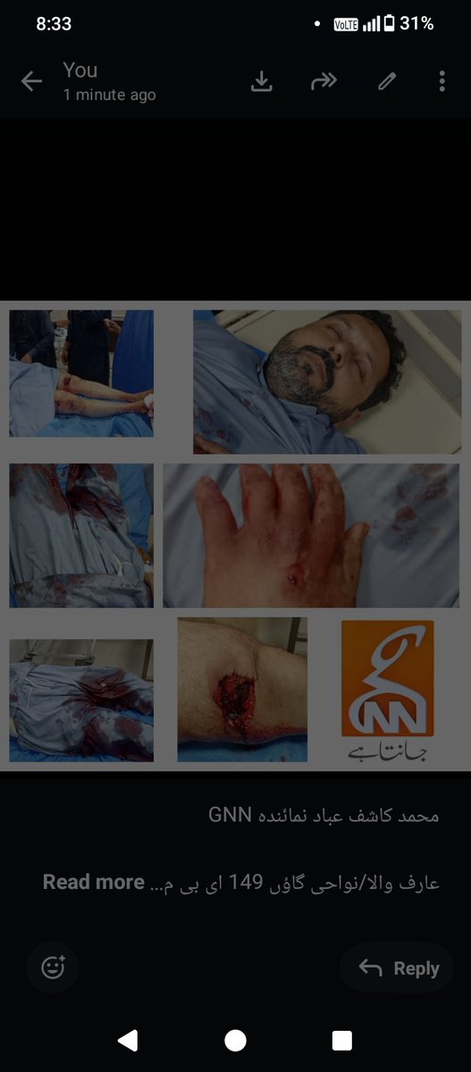 عارف والا/نواحی گاؤں 149 ای بی میں فائرنگ سے ایک شخص شدید زخمی ہے عارف والادو لڑکوں کی آپس میں لڑائی تھی جس پر ملزم کی فائرنگ سے صغیر اسماعیل شدید زخمی ہوگیا     <a href="/OfficialDPRPP/">Punjab Police Official</a>   اگر پولیس ٹائم سے ایکشن لیتی تو واقعہ نہ ہوتا لیکن پاکستانی پولیس دنیا کی worst policeہے