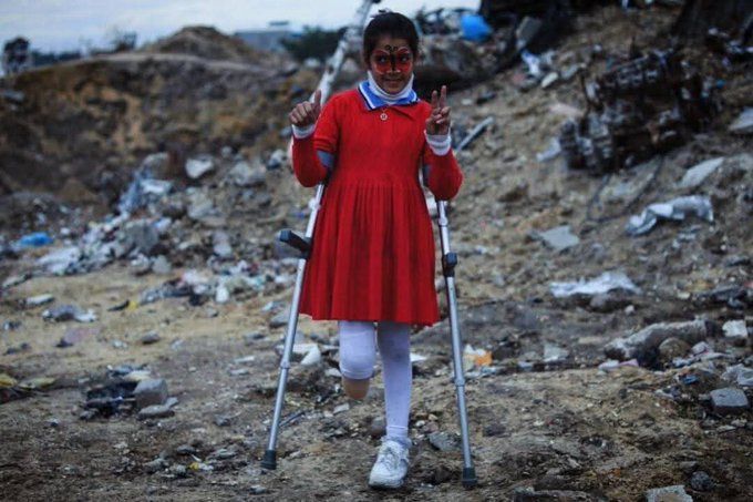 MyPalestine0's tweet photo. لم تبلغ من العمر ثمانية سنوات، فقدت والديها ومنزلها وقدمها وكل شي حلو في الحياة https://t.co/Mzj7jik4tF