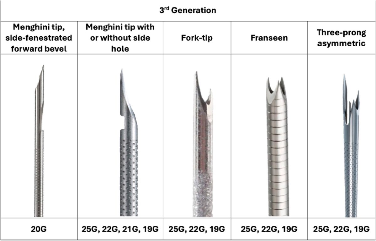 AGA_Gastro's tweet image. 💡 Review examines emerging diagnostic indications for endoscopic ultrasound, including artificial intelligence applications. Read the full article here: ow.ly/KeBf50YMPoT