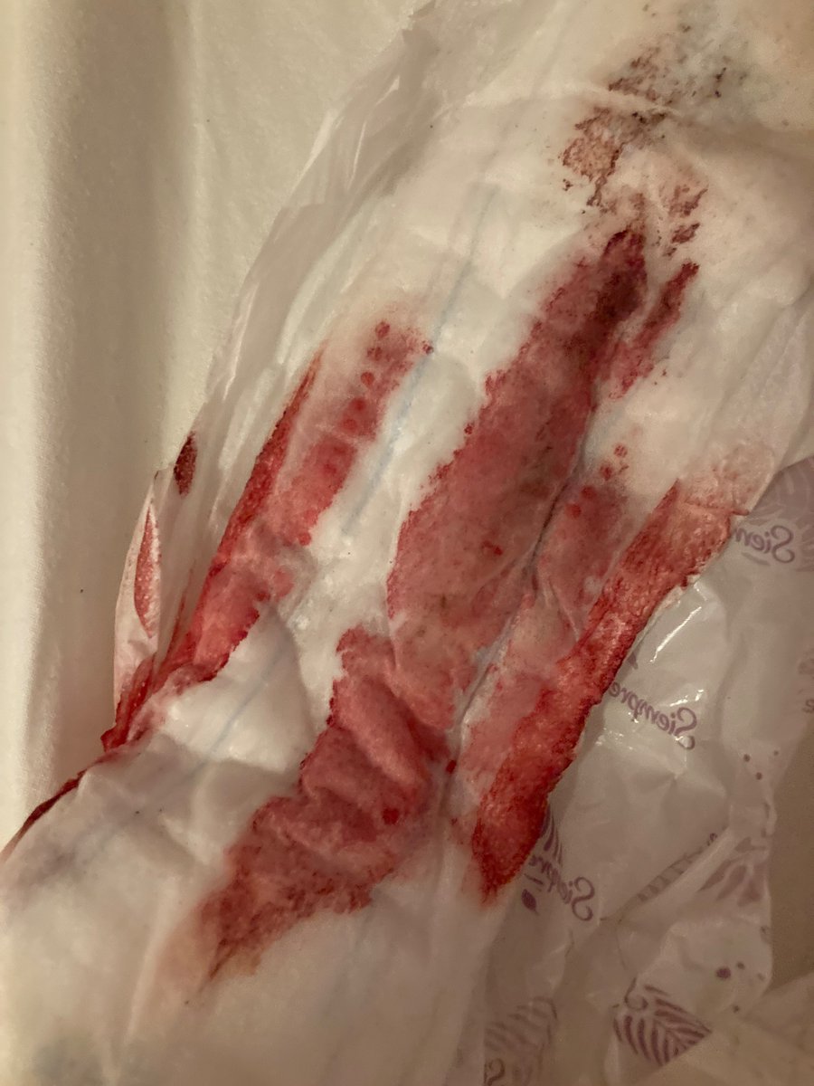 mullfresser26's tweet image. Wieder mal fündig geworden ❤️

#tampon #menstruation #period #periodensklave #periodslave #pad #sanitarypad #binde #müll #abfall #toilette #toilettensklave #müllfresser #ekelsklave #ekel