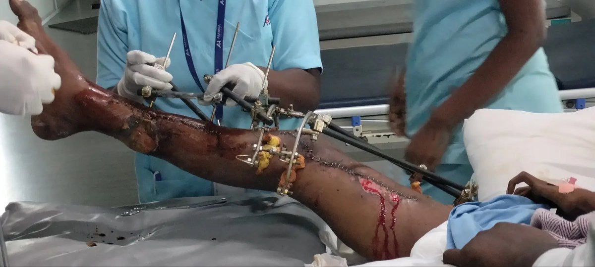 Ravikumar Kwt tweet media