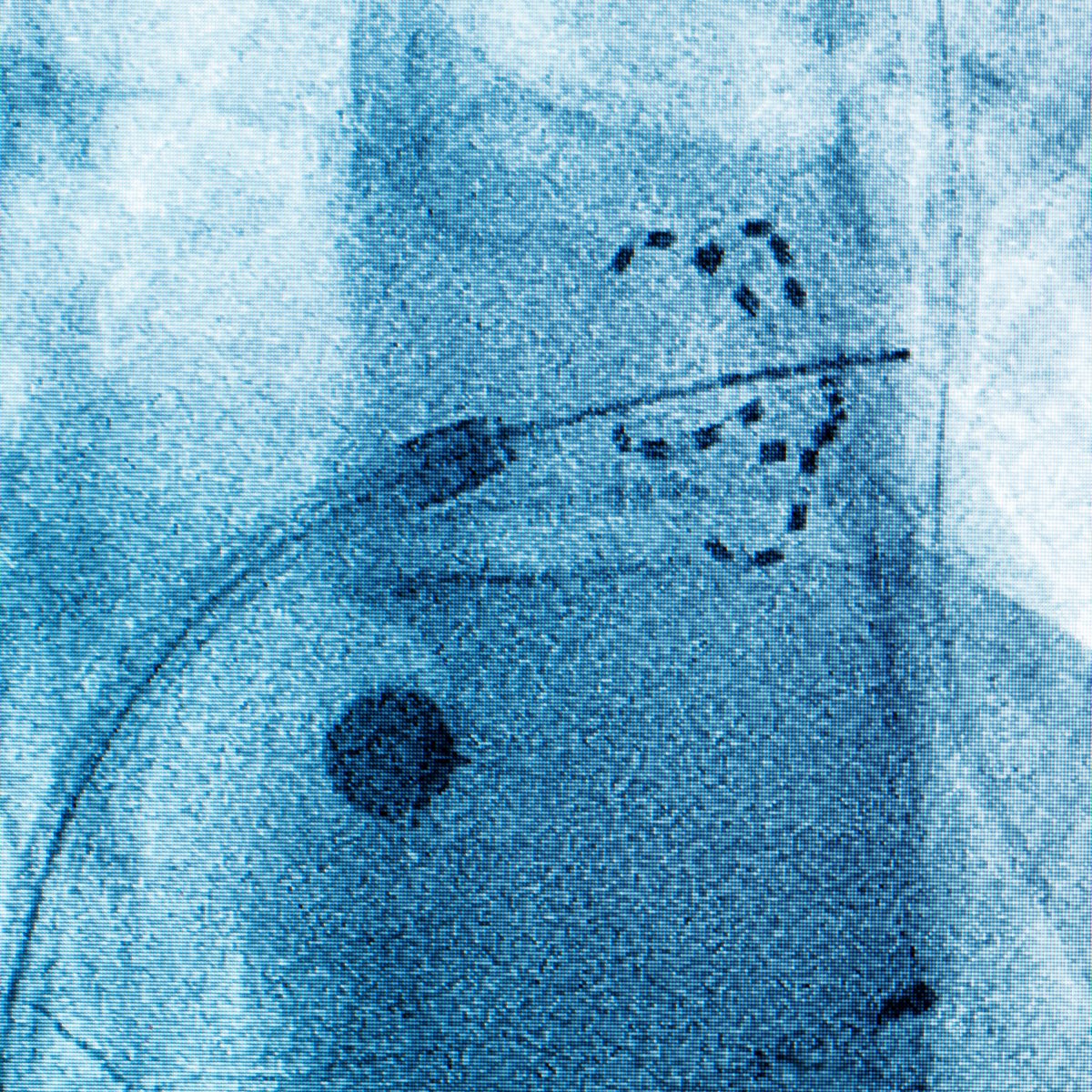ClevelandClinic's tweet photo. A new Cleveland Clinic-led study shows ablation can be more effective than medication as a first treatment for people with persistent atrial fibrillation (AFib). #HRS2026

Learn more: https://t.co/HlQVv3cMrF https://t.co/amDyYSXKHm