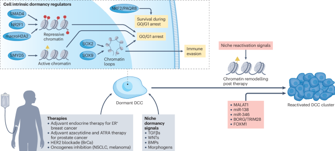 NatureRevCancer's tweet image. NEW content online! The sleeping threat: targeting cancer dormancy to transform metastasis therapy dlvr.it/TSCZXS