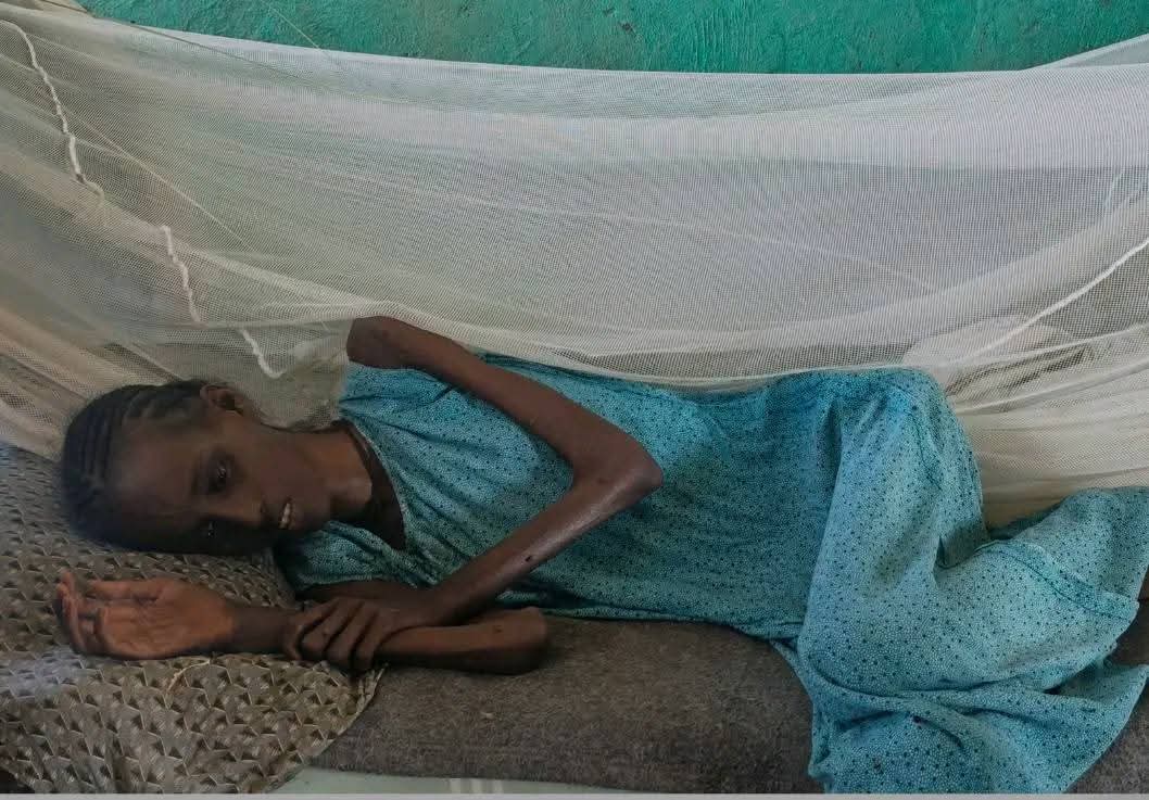 Danaity70's tweet image. 2
The Civil Umbrella, the community of West Tigray, said that the displaced people in the shelter in Selekela; 
@UN @UNHumanRights @AUC_PAPS @_AfricanUnion @achpr_cadhp @UKParliament @FCDOGovUK @EU_Commission @StateDept @IntlCrimCourt #DiplomacyDay #Multilateralism #Tigrayans
