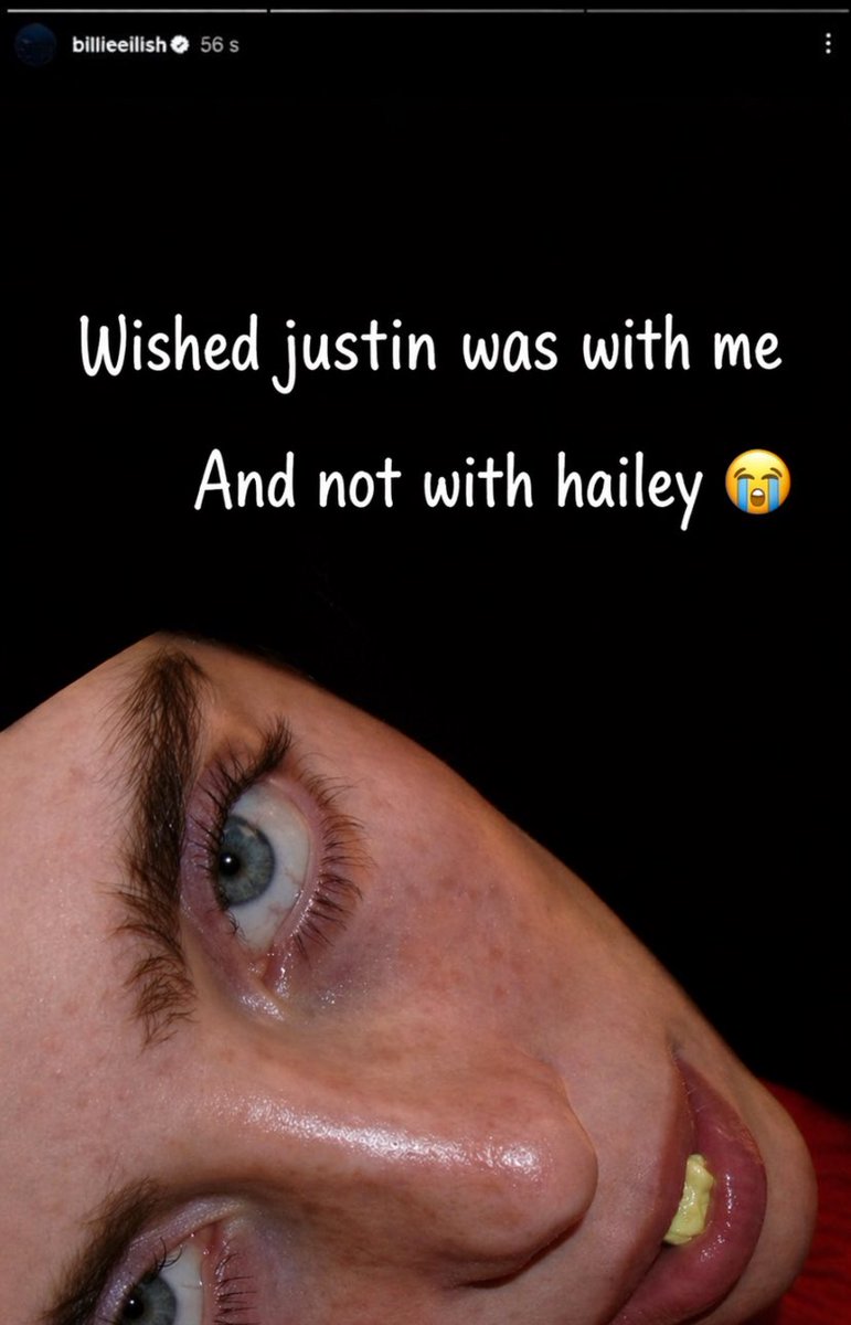 SIR1⭐️ tweet media