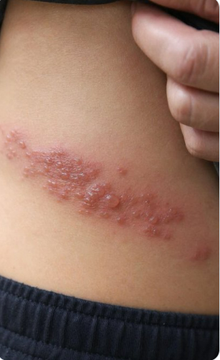 Elise Wilshaw tweet media