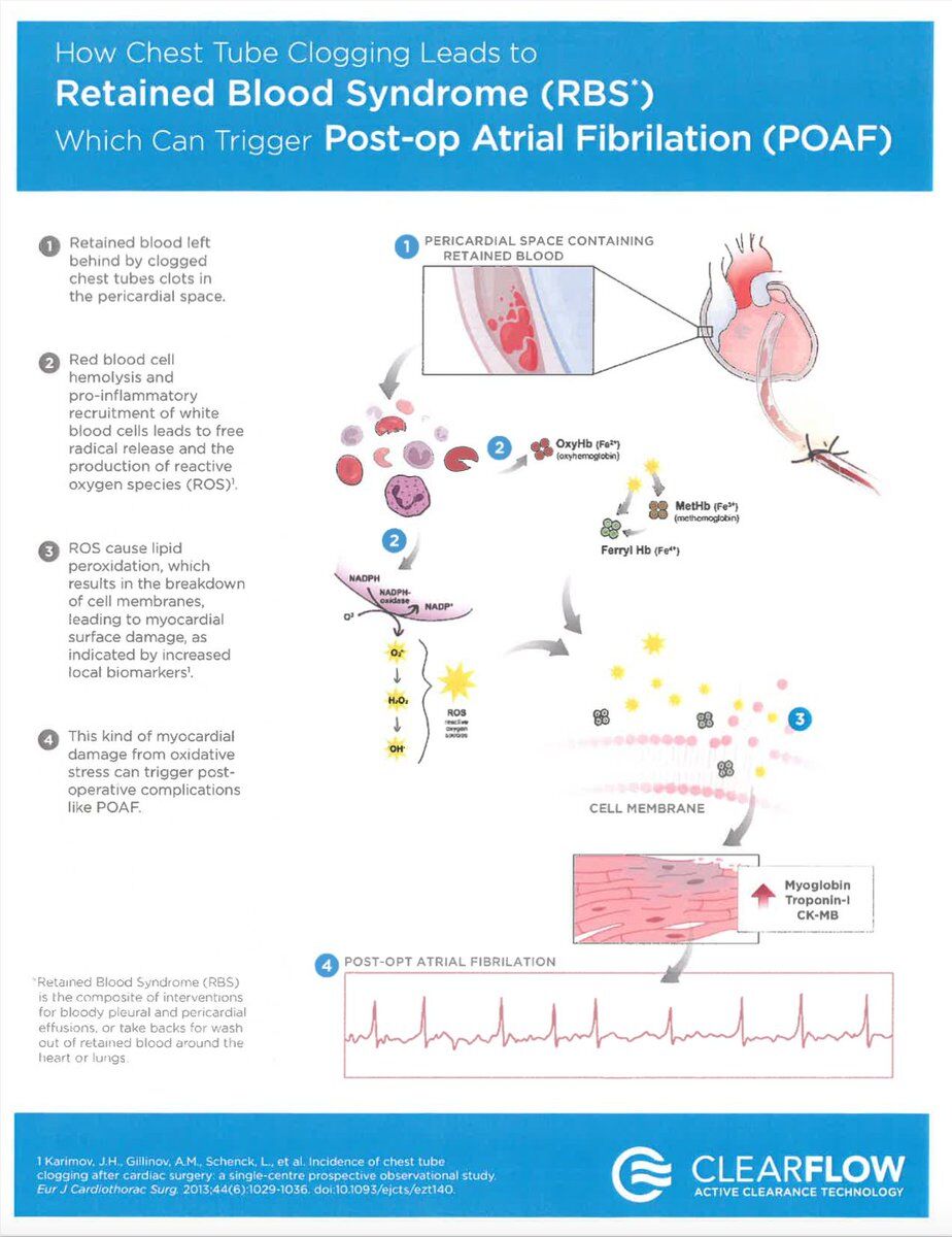 ClearFlowMed's tweet photo. Avoid retained blood around the heart, reduce the risk of POAF. 

Clear chest tubes proactively with the PleuraFlow® Active Clearance Technology® (ACT) System. 

Check it out at https://t.co/PFHn4vx0n9 https://t.co/t5Upitc7Lp