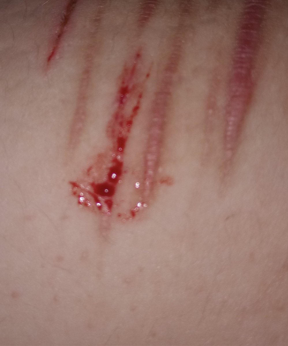 🇧🇷 starlight of shtwt tweet media