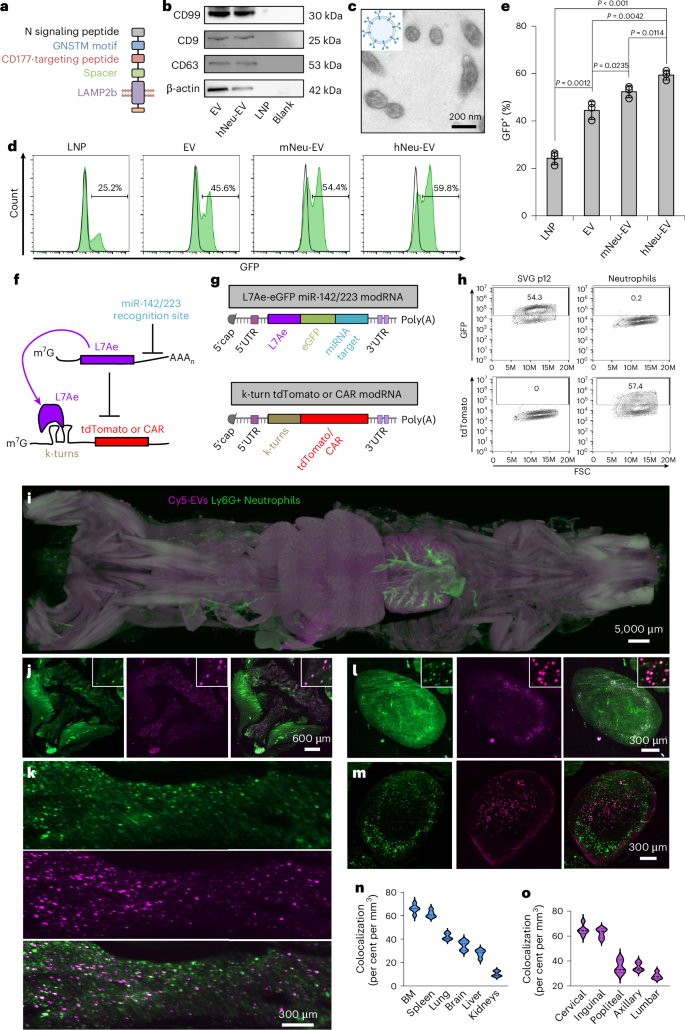 LabWaggoner's tweet photo. CAR-neutrophils produced in vivo to treat glioma @natBME @PurdueResearch @penn_state 
https://t.co/uFwVeB8n1a https://t.co/DUvaTQCkKO