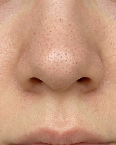 かぐや tweet media