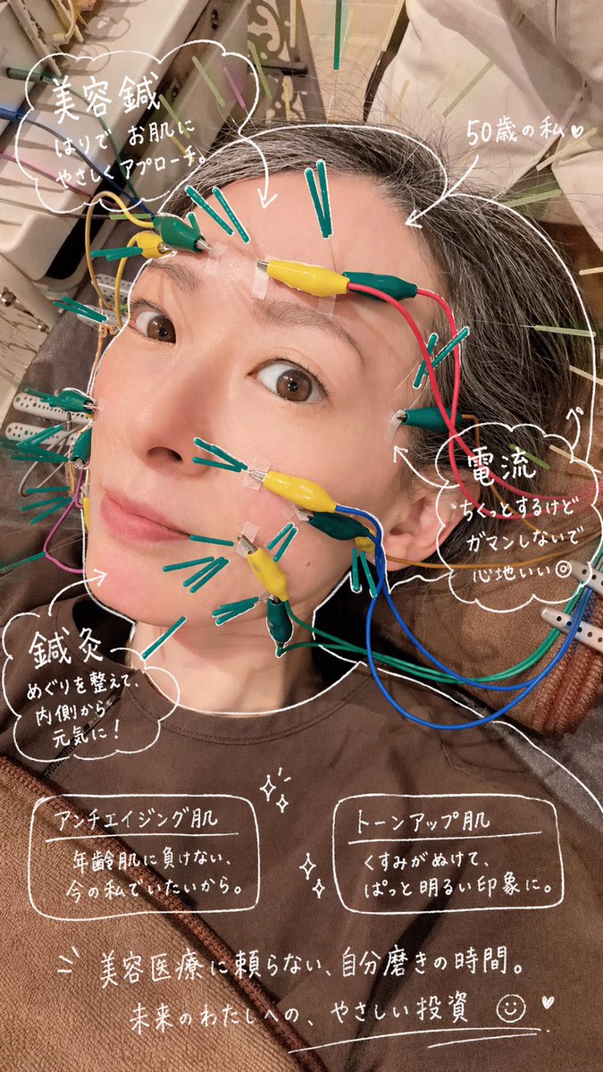 50歳/美容医療に頼らない選択もある。
私は東京目白の竹田先生のデザイン美容鍼®︎で美肌メンテナンス中。
シワが出来にくくなりトーンアップした肌がお気に入り。
ボトックス失敗から移行される方も多い最先端の美容鍼。
harikyuseikotuin.com/menu/beauty_ac…
